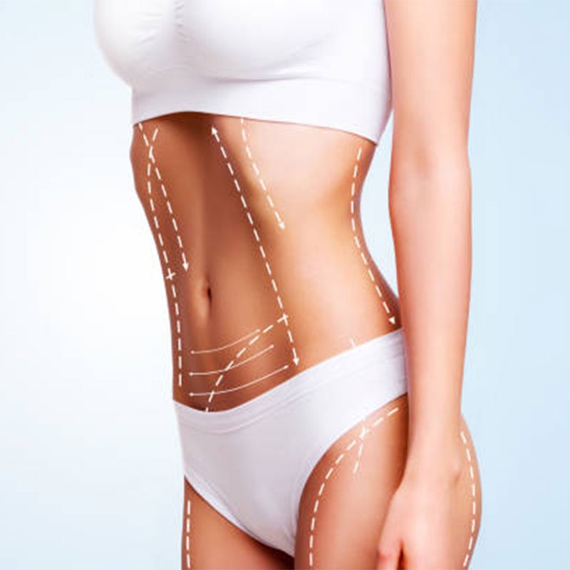 Power Assisted Liposuction