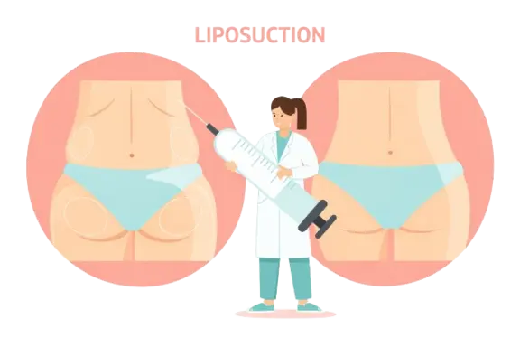 liposuction surgery in nashik